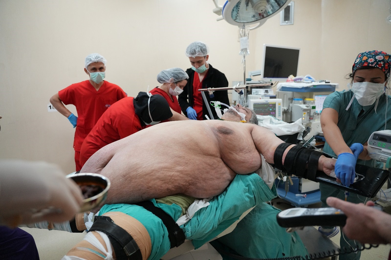 Hastaneye sedye ile gelen 310 kiloluk Aydınlı adam yürüyerek taburcu oldu